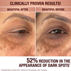 DARK SPOT CORRECTING INVISIBLE UV DUO - SKINCARE KIT