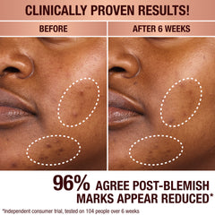DARK SPOT CORRECTING INVISIBLE UV DUO - SKINCARE KIT
